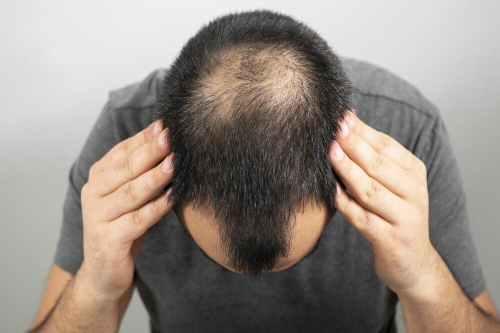 AHCC for Hair Loss